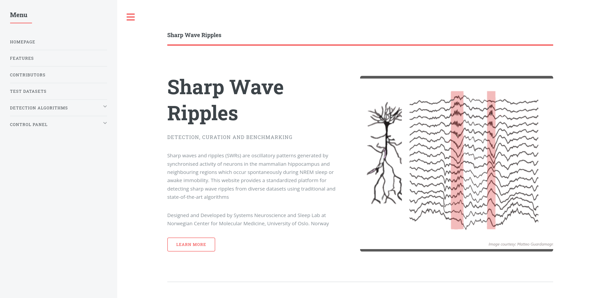 Sharp Wave Ripples